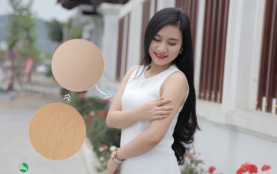 bảng giá triệt lông thu cúc