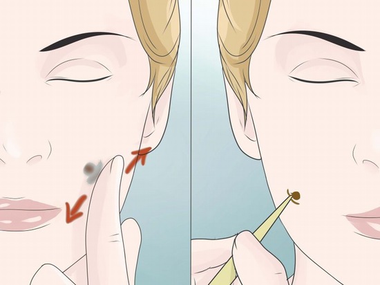 cách tạo má lúm đồng tiền tại nhà