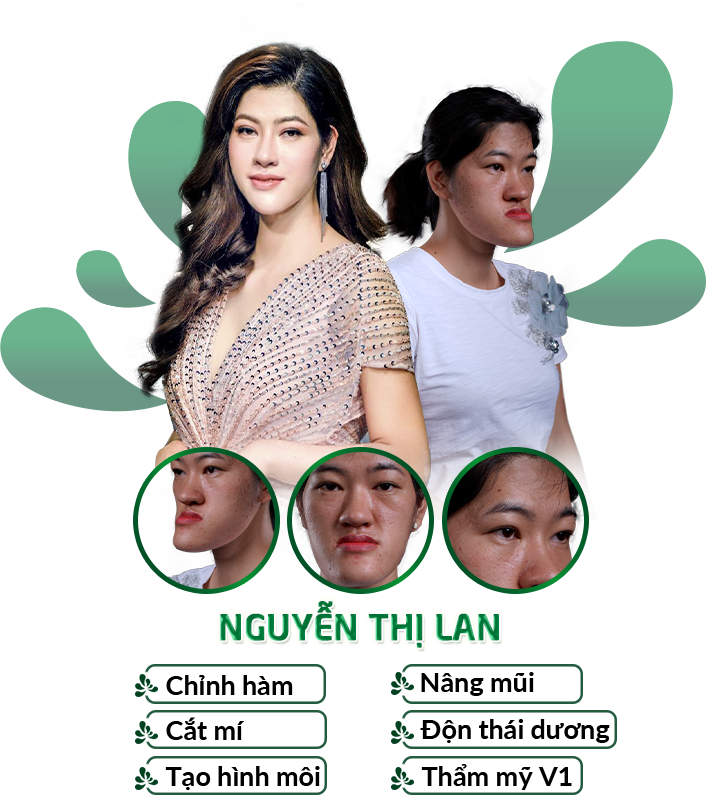 thilan_1