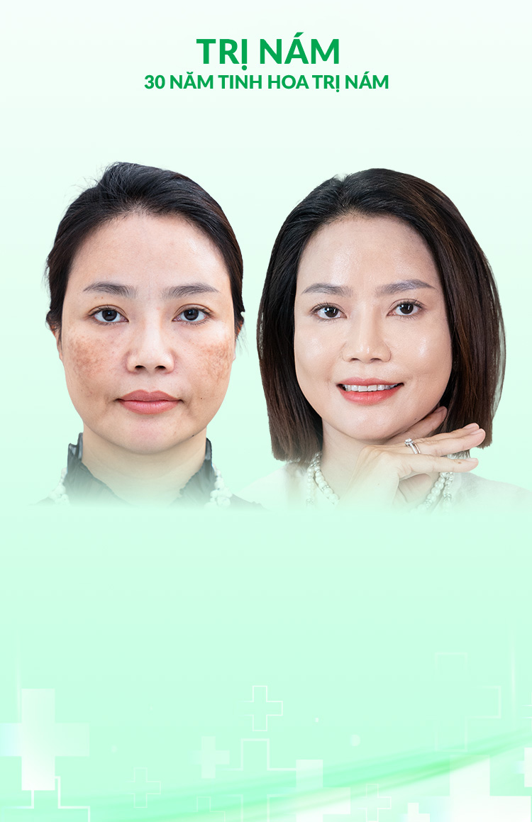 t1m-banner