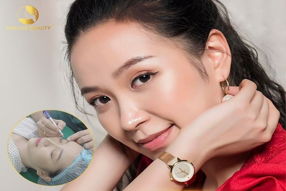 Có nên phẫu thuật cắt mí mắt không? 8 thắc mắc thường gặp nhất