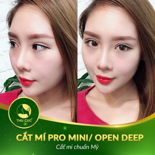 cat-mi-mat-tren-can-kieng-gi4