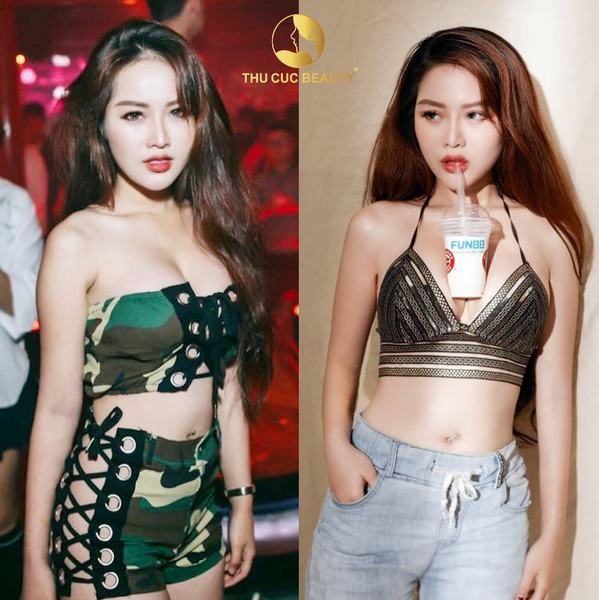 6-luu-y-sau-khi-hut-mo-bung-de-giup-vet-thuong-nhanh-hoi-phuc