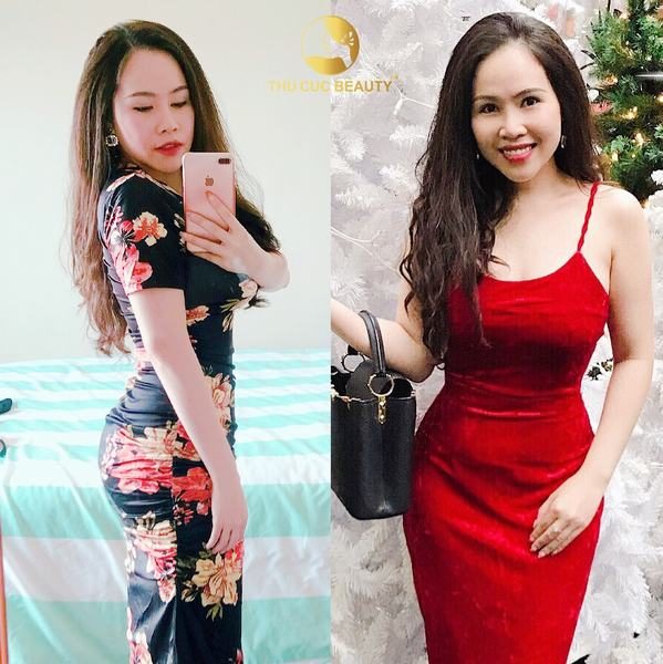 6-luu-y-sau-khi-hut-mo-bung-de-giup-vet-thuong-nhanh-hoi-phuc