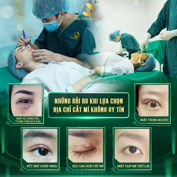 tác hại của cắt mí mắt