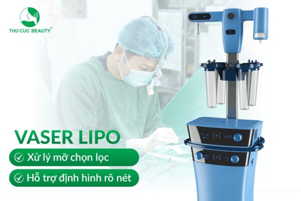 Hút mỡ má: Phương pháp sở hữu gương mặt thon gọn 3 hut mo bang cong nghe vaser lipo e1769741741923