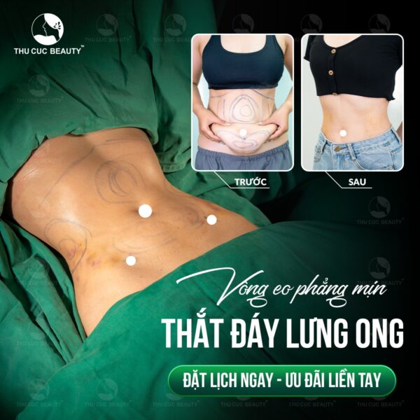 Hút mỡ toàn thân giá bao nhiêu tiền?