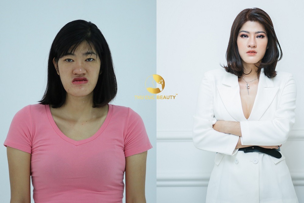 Hành trình “vịt hóa thiên nga” của 9x tham dự Reborn Tái Sinh