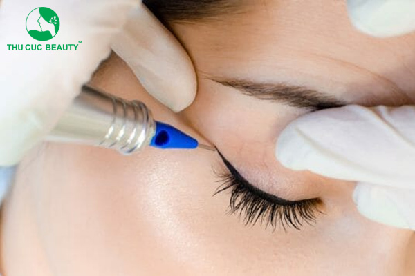 Giải đáp thắc mắc: Phun mí mắt bị sưng trong bao lâu?