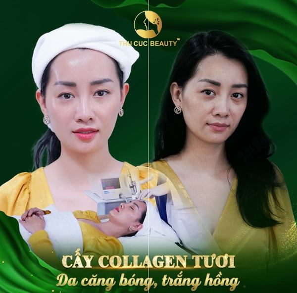 cay-collagen-tuoi-16