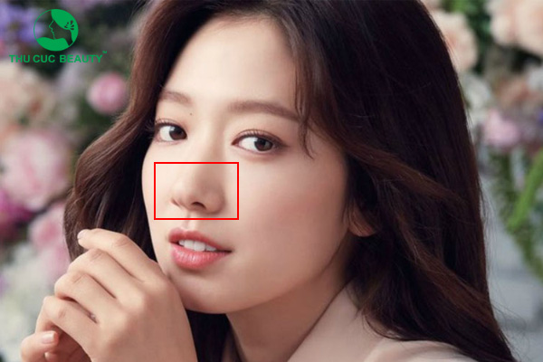 Mũi chẻ là gì? Mũi chẻ có ảnh hưởng đến tướng số không?