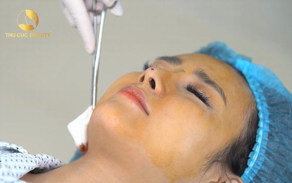 nang mui lightly plus cau truc 2