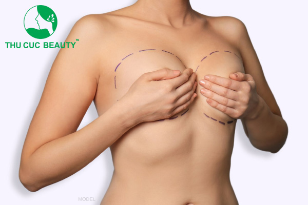 Chia sẻ kinh nghiệm đi nâng ngực đẹp, an toàn