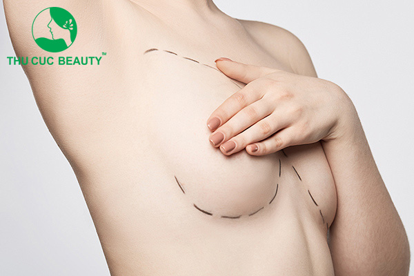 Nâng ngực đường nào an toàn?