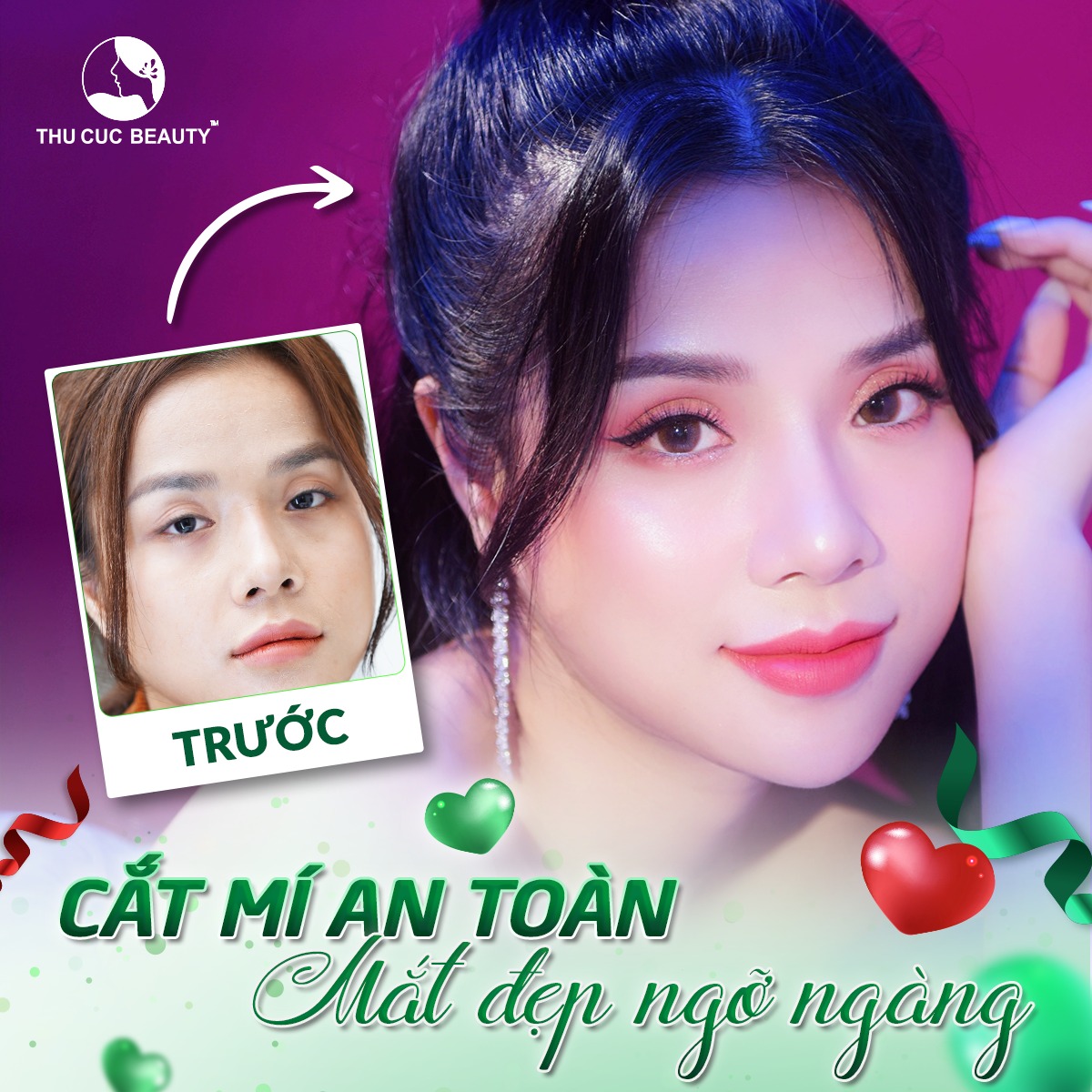 Nguyên Tắc Chăm Sóc Sau Cắt Mí Mắt Bạn Cần Biết