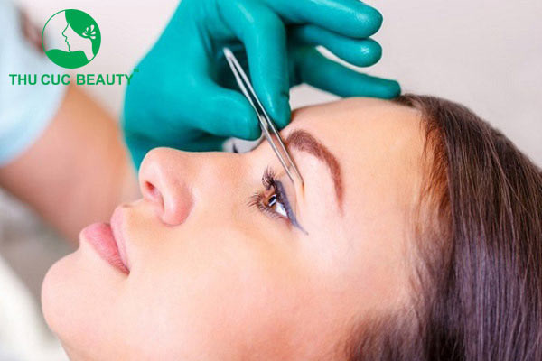 Cắt mí bao lâu thì cắt chỉ