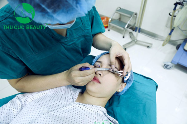 CẮT MÍ ĐAU KHÔNG? LÀM GÌ ĐỂ MÍ BỚT ĐAU VÀ NHANH LÀNH?