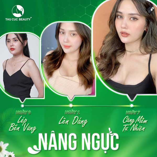 Nâng ngực có ảnh hưởng gì không? Nên làm gì nếu gặp biến chứng sau phẫu thuật?