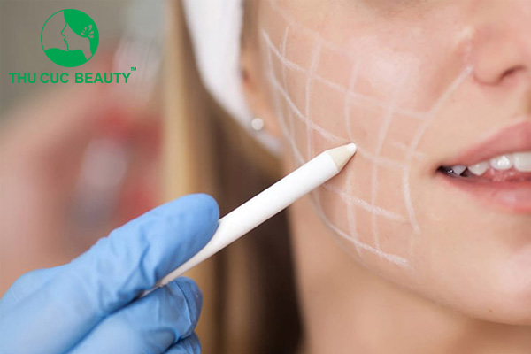 Hút mỡ má nguy hiểm không?