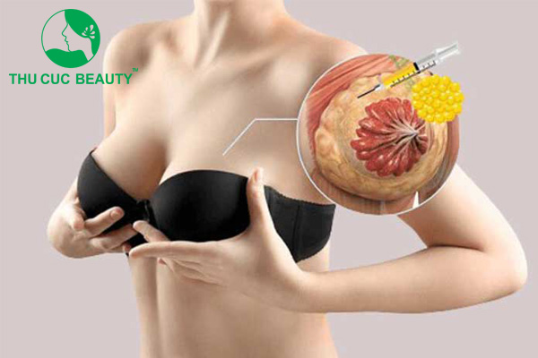 Hút mỡ ngực nguy hiểm không?