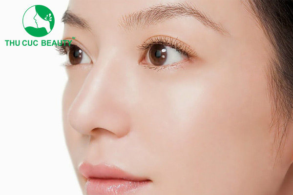 Mắt lồi có nên cắt mí không