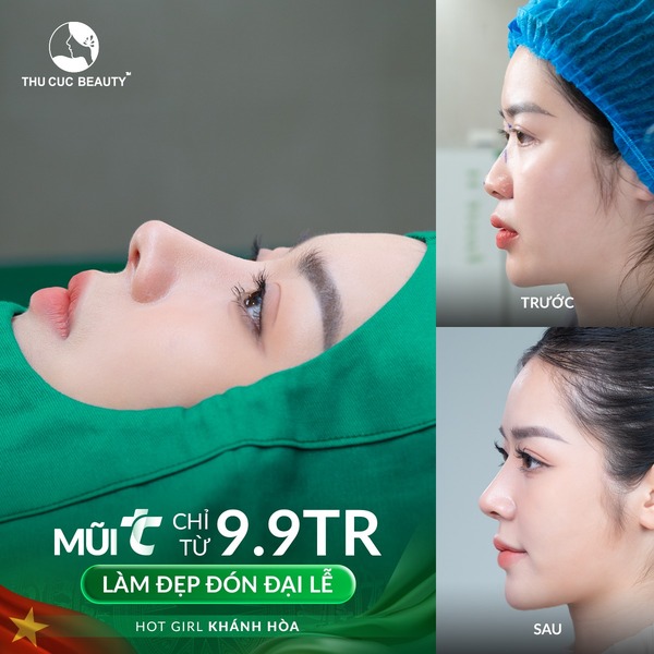 nâng mũi giá bao nhiêu tiền