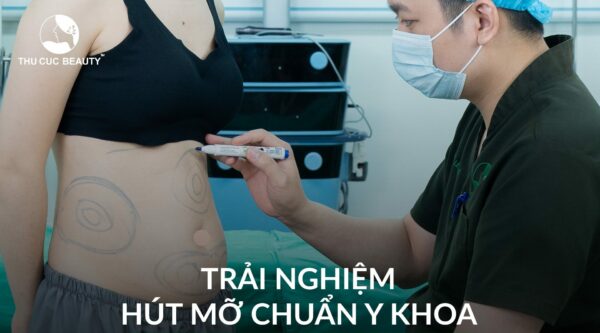 Quy trình hút mỡ bụng và những điều cần biết 2 Quy trình hút mỡ bụng