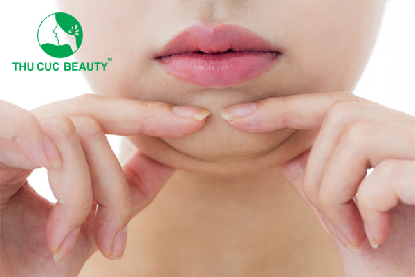 Hút mỡ cằm và những lưu ý cần biết