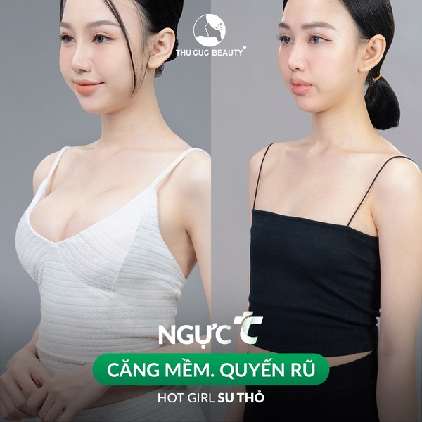 Hình ảnh trước và sau nâng ngực