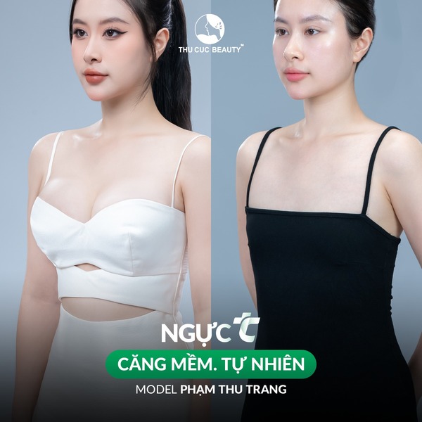 Hình ảnh trước và sau nâng ngực