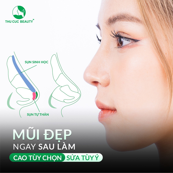 Nâng Mũi TC – Phẫu Thuật Nâng Mũi An Toàn