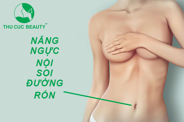 Nâng ngực nội soi đường rốn