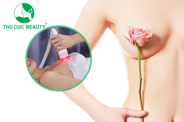 Làm hồng nhũ hoa bằng laser là gì? Giá bao nhiêu?