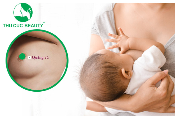 Nâng ngực đường quầng có cho con bú được không?