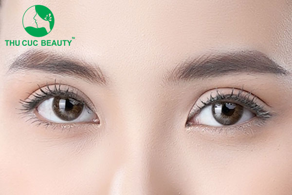 Cắt mí mắt ở Nhật Bản nên hay không?