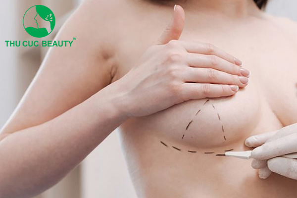 Nâng ngực nằm viện bao lâu?