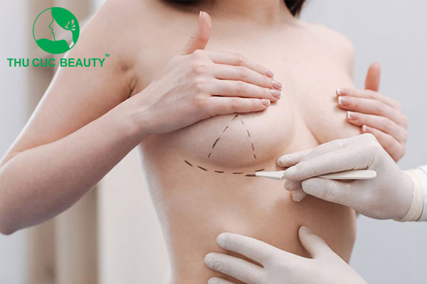 Nâng ngực phải nghỉ dưỡng bao lâu?