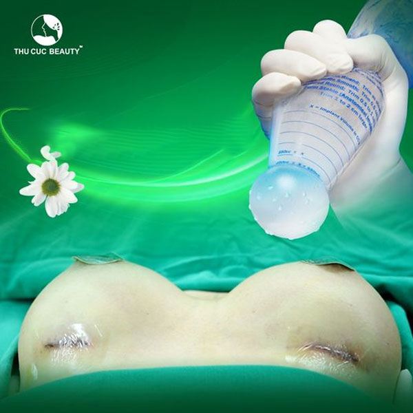 Nâng ngực không chạm