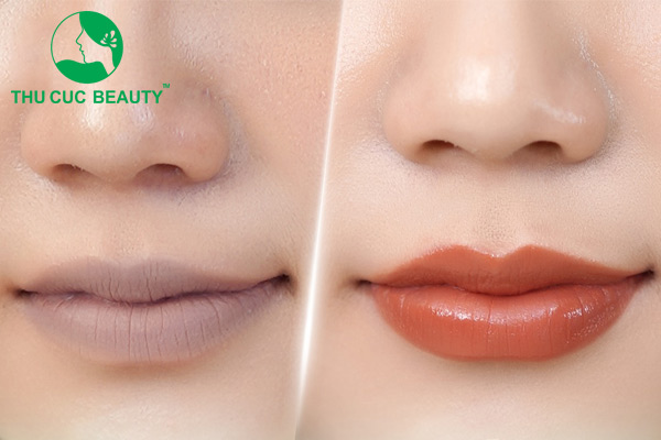 Khử thâm môi sau bao lâu lên màu?