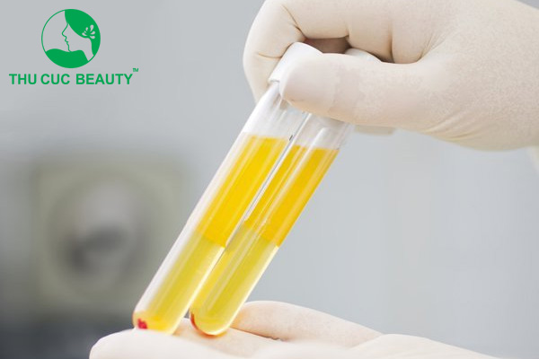 Nâng ngực bằng huyết tương và những điều cần biết