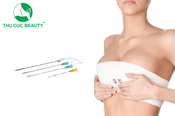 Cấy chỉ nâng ngực cải thiện vòng 1 chảy xệ