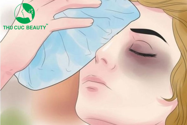 Nâng mũi nghỉ dưỡng bao lâu? 4 giai đoạn hồi phục phải biết