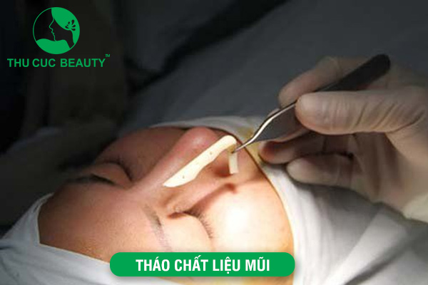 Tháo chất liệu mũi là gì?