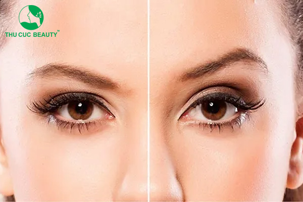 Nâng cung mày bị hỏng: Nguyên nhân và cách khắc phục