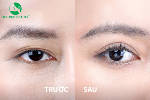 Nhấn mí Thái Lan Deep Eyes có gì đặc biệt? Giá bao nhiêu?