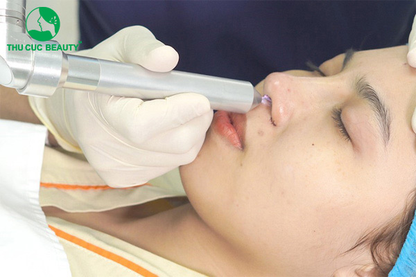 Hút dịch sau nâng mũi có đau không?