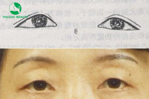 Vận số người có tướng mắt tam giác như thế nào?