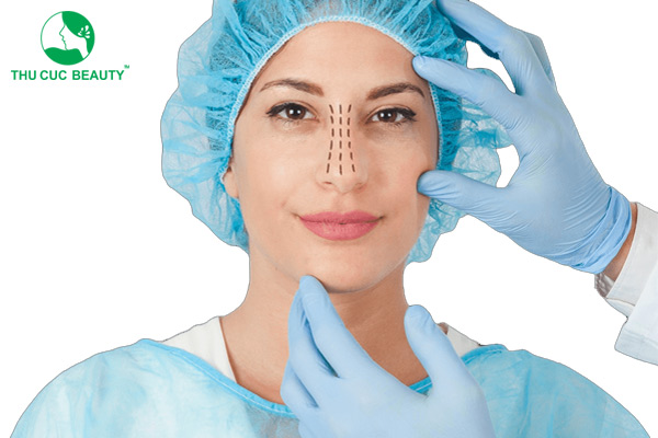 Nên tiêm filler hay nâng mũi? Phương pháp nào tốt hơn