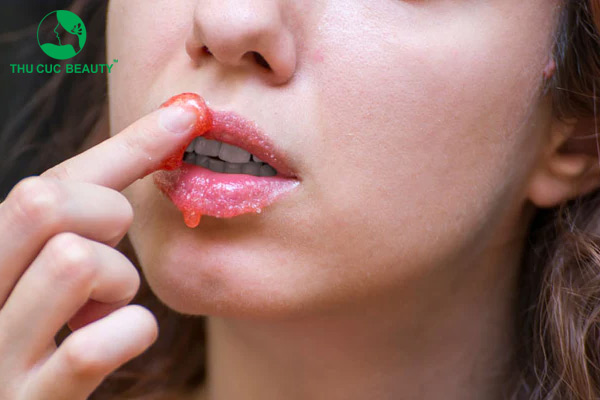 12 cách làm môi hồng tự nhiên cho nam và nữ tại nhà