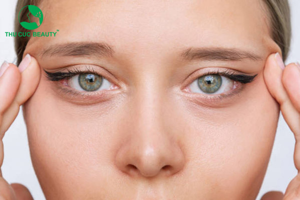 14 tướng mắt xấu và cách khắc phục hiệu quả